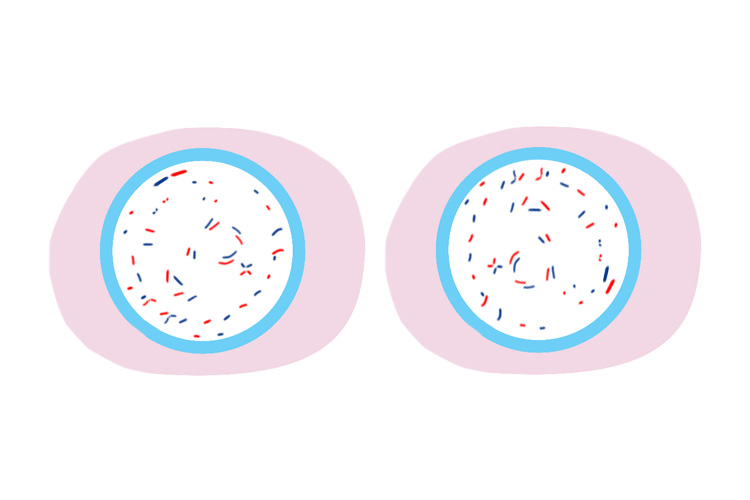 2 cells each containing 46 chromosomes