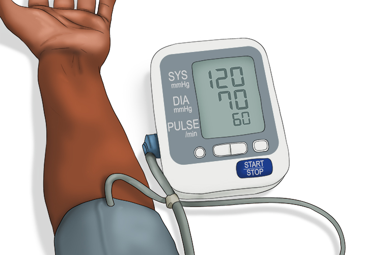 Blood pressure can be taken on the arm as follows: