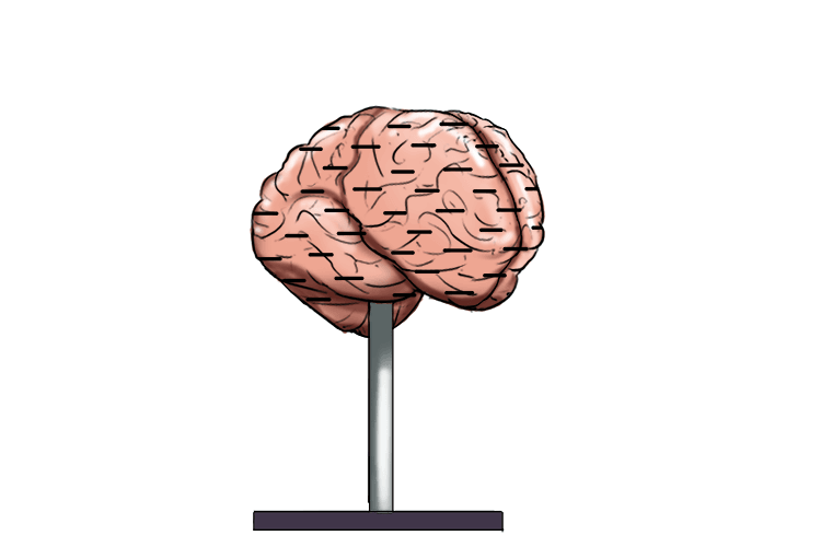 and put dashes on the brains when they were out of the store cupboard