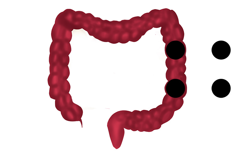 A colon is used to indicate detail or statement after a word