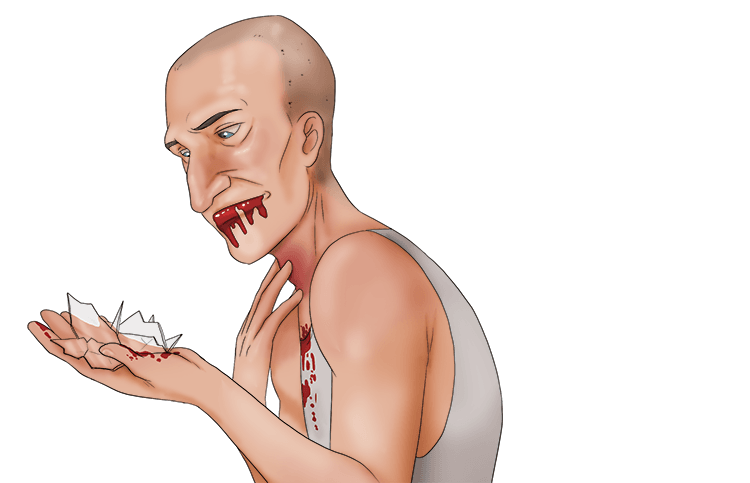 I had a sore throat after gorging (gorge) on broken glass.