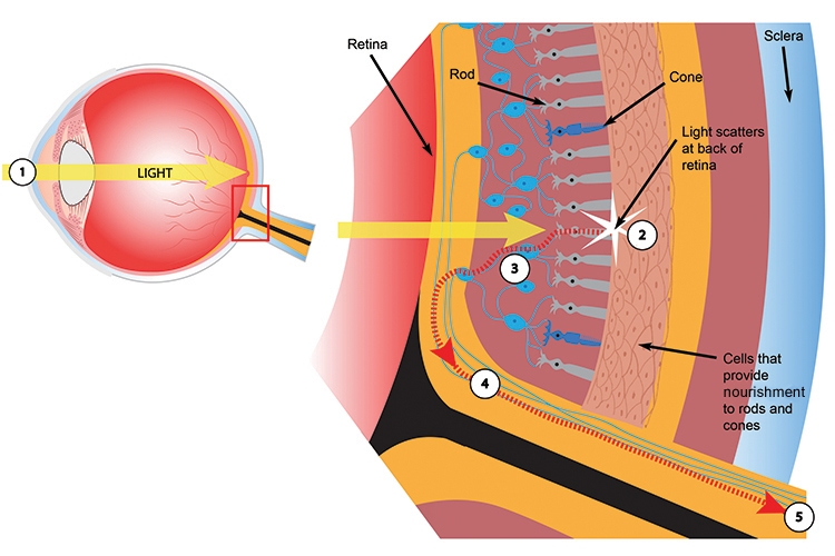 The light picture projected by the lens onto the retina is sent to the rod and cone cells